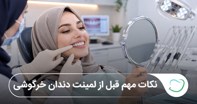 نکات مهم قبل از لمینت دندان خرگوشی؛ راهنمای کامل زیبایی دندان❤️(بهروزرسانی1405) نکات مهم قبل از لمینت دندان خرگوشی؛ راهنمای کامل زیبایی دندان❤️(بهروزرسانی1405)