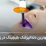 بهترین دندانپزشک بلیچینگ در زرینشهر 🦷【آپدیتسال1405】✅ بهترین دندانپزشک بلیچینگ در زرینشهر 🦷【آپدیتسال1405】✅