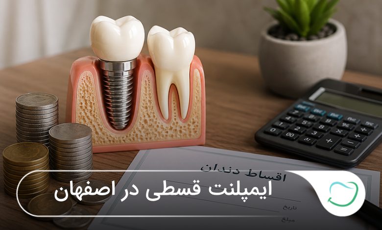 ایمپلنت قسطی در اصفهان ✅️【سال1405】❤️ ایمپلنت قسطی در اصفهان ✅️【سال1405】❤️