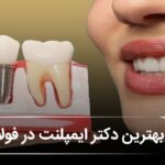 بهترین دکتر ایمپلنت در فولادشهر 🦷【آپدیتسال1405】⚡ بهترین دکتر ایمپلنت در فولادشهر 🦷【آپدیتسال1405】⚡