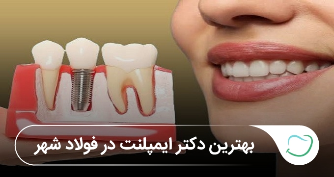 بهترین دکتر ایمپلنت در فولادشهر 🦷【آپدیتسال1405】⚡ بهترین دکتر ایمپلنت در فولادشهر 🦷【آپدیتسال1405】⚡