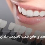قیمت کامپوزیت دندان در اصفهان【بهروزرسانی1405】✨🦷 قیمت کامپوزیت دندان در اصفهان【بهروزرسانی1405】✨🦷