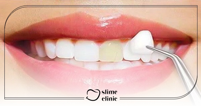 چرا کلینیک دکتر باقریاننژاد را انتخاب کنیم؟
