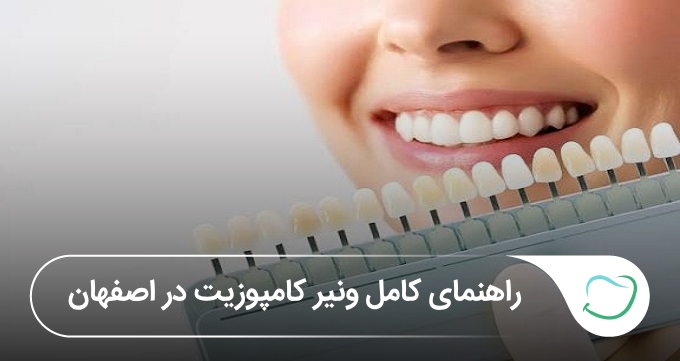 ونیر کامپوزیت در اصفهان【آپدیتسال1405】🦷 ونیر کامپوزیت در اصفهان【آپدیتسال1405】🦷