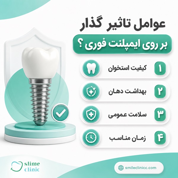 ایمپلنت فوری چیست و چگونه انجام میشود؟