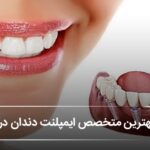 بهترین متخصص ایمپلنت دندان در اصفهان❤️【آپدیتسال1405】✅️ بهترین متخصص ایمپلنت دندان در اصفهان❤️【آپدیتسال1405】✅️
