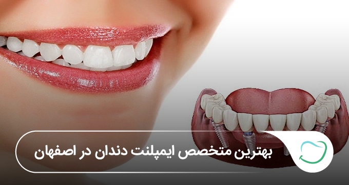 بهترین متخصص ایمپلنت دندان در اصفهان❤️【آپدیتسال1405】✅️ بهترین متخصص ایمپلنت دندان در اصفهان❤️【آپدیتسال1405】✅️