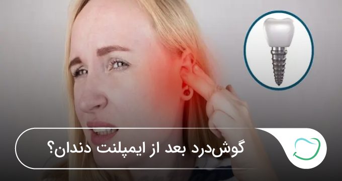 گوشدرد بعد از ایمپلنت دندان؟ ✅【سال1405】🦷 گوشدرد بعد از ایمپلنت دندان؟ ✅【سال1405】🦷