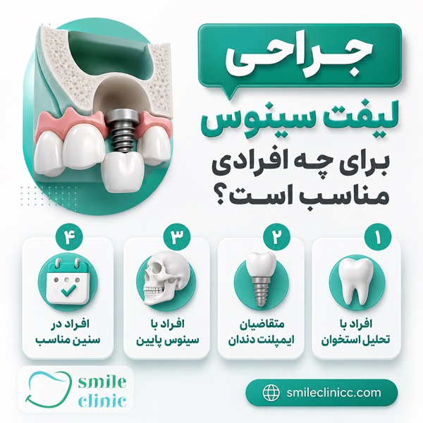 چرا قبل از ایمپلنت دندان لیفت سینوس انجام میشود؟