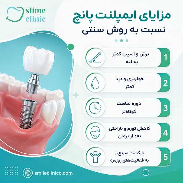 ایمپلنت پانچ چیست و چگونه انجام میشود؟