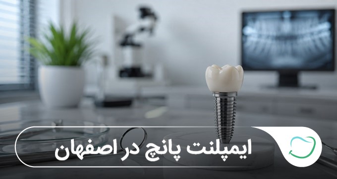 ایمپلنت پانچ در اصفهان 🦷【آپدیتسال1405】 ایمپلنت پانچ در اصفهان 🦷【آپدیتسال1405】