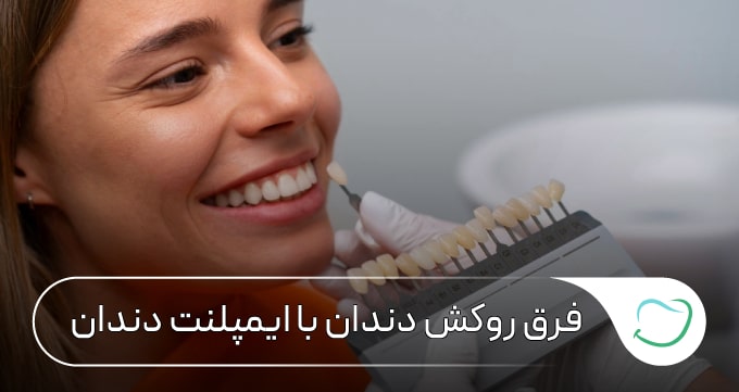 فرق روکش دندان با ایمپلنت دندان 🦷【سال1405】💗 فرق روکش دندان با ایمپلنت دندان 🦷【سال1405】💗