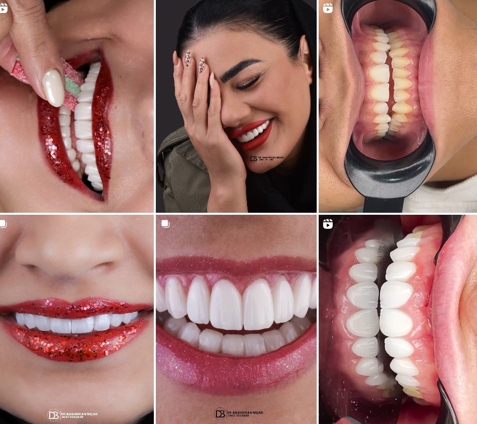 کامپوزیت ژاپنی در اصفهان