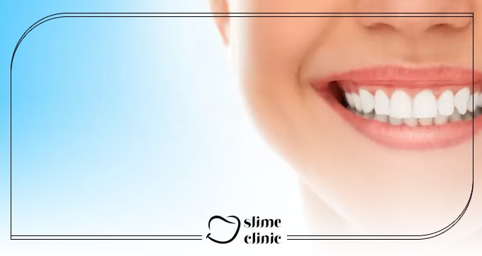 فرآیند نصب و ترمیم با کامپوزیت آلمانی