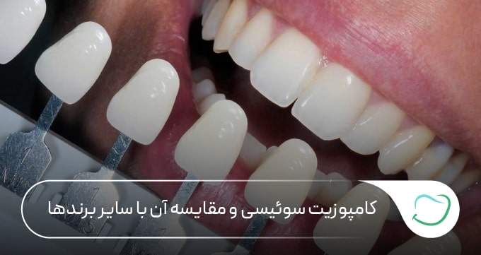 کامپوزیت سوئیسی و مقایسه آن با سایر برندها 🦷 کامپوزیت سوئیسی و مقایسه آن با سایر برندها 🦷