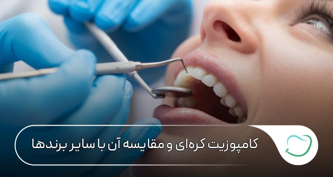 کامپوزیت کرهای و مقایسه آن با سایر برندها ⭐ کامپوزیت کرهای و مقایسه آن با سایر برندها ⭐