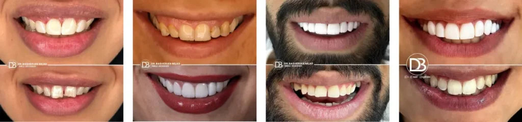 نمونه کار دکتر باقریان نژاد
