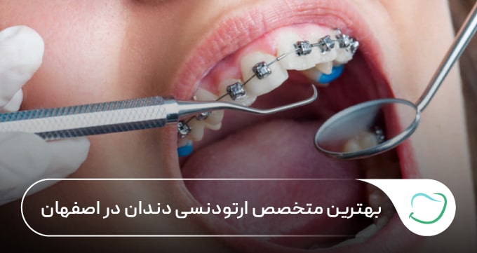 بهترین متخصص ارتودنسی دندان در اصفهان 🦷【سال1405】✅ بهترین متخصص ارتودنسی دندان در اصفهان 🦷【سال1405】✅