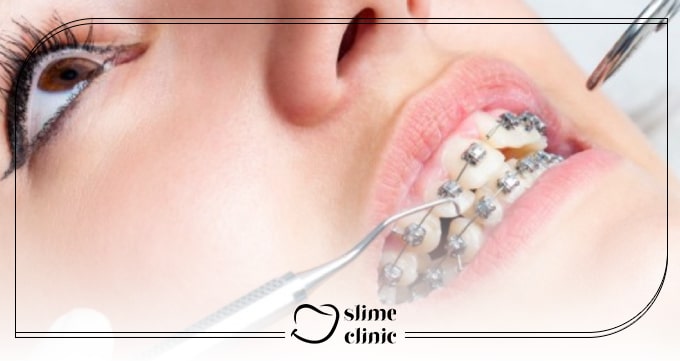 ارتودنسی چیست و چرا مهم است؟