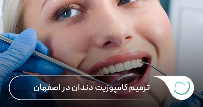 ترمیم کامپوزیت دندان در اصفهان 🦷【سال1405】💗 ترمیم کامپوزیت دندان در اصفهان 🦷【سال1405】💗