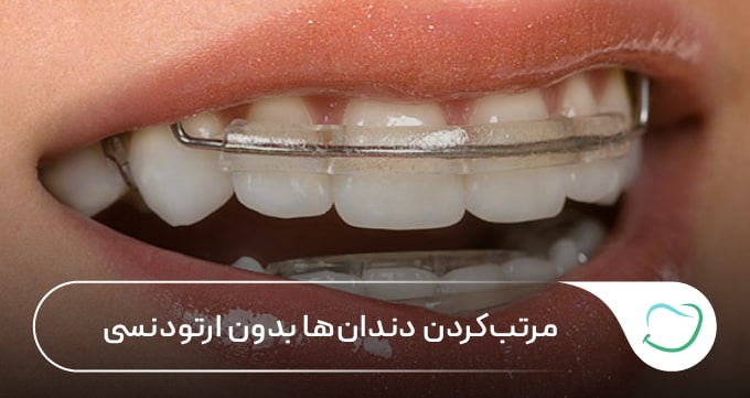 مرتبکردن دندانها بدون ارتودنسی 🦷【سال1405】⭐ مرتبکردن دندانها بدون ارتودنسی 🦷【سال1405】⭐