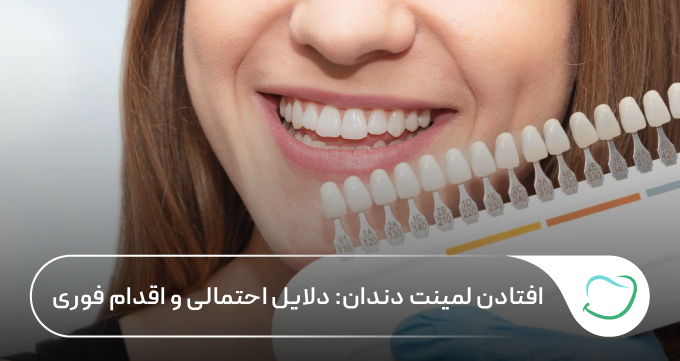 افتادن لمینت دندان: دلایل احتمالی و اقدام فوری 🦷【سال1405】✅ افتادن لمینت دندان: دلایل احتمالی و اقدام فوری 🦷【سال1405】✅