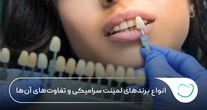 انواع برندهای لمینت سرامیکی و تفاوتهای آنها 🦷【سال1405】⭐ انواع برندهای لمینت سرامیکی و تفاوتهای آنها 🦷【سال1405】⭐