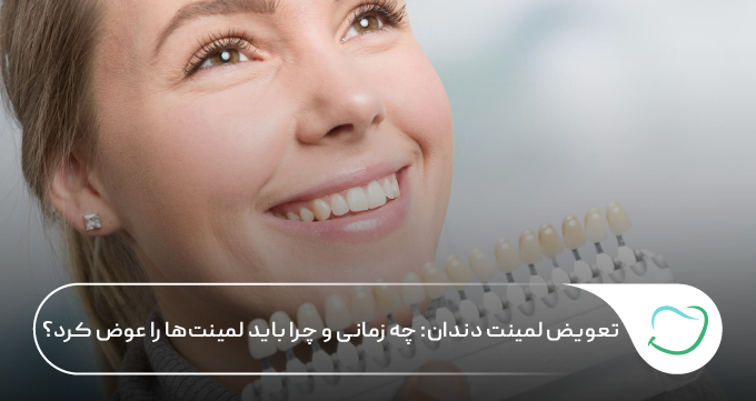 تعویض لمینت دندان: چه زمانی و چرا باید لمینتها را عوض کرد؟ 🦷【سال1405】✅ تعویض لمینت دندان: چه زمانی و چرا باید لمینتها را عوض کرد؟ 🦷【سال1405】✅