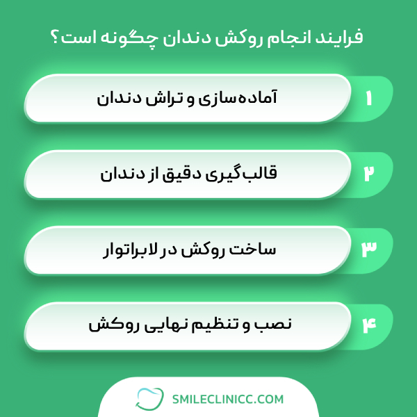 مراحل انجام روکش دندان در اصفهان