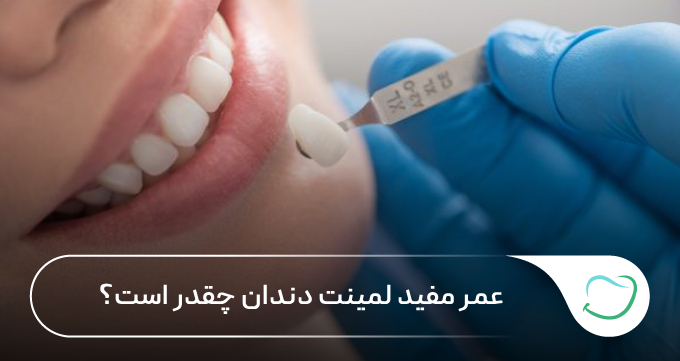 عمر مفید لمینت دندان چقدر است؟ 🦷【سال1405】⭐ عمر مفید لمینت دندان چقدر است؟ 🦷【سال1405】⭐