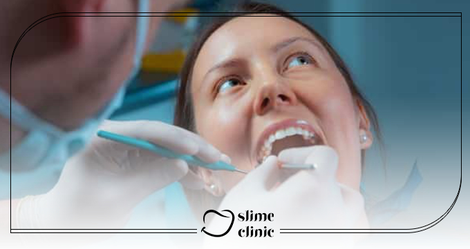 لمینت دندان چیست و چرا محبوب است؟