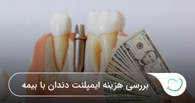 بررسی هزینه ایمپلنت دندان با بیمه 🦷【سال1405】⭐ بررسی هزینه ایمپلنت دندان با بیمه 🦷【سال1405】⭐