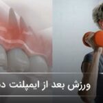 ورزش بعد از ایمپلنت دندان🦷【بهروزرسانی سال1405】✅ ورزش بعد از ایمپلنت دندان🦷【بهروزرسانی سال1405】✅