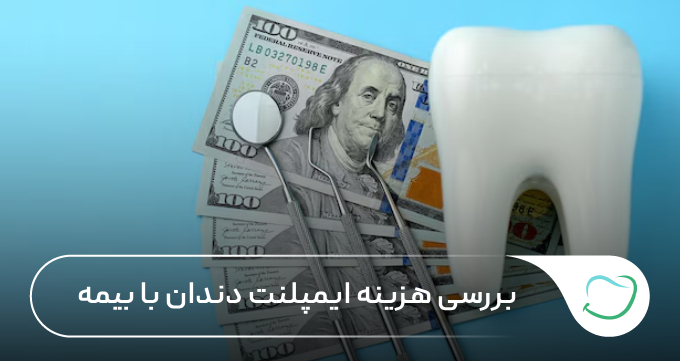 بررسی هزینه ایمپلنت دندان با بیمه 🦷【سال1405】⭐ بررسی هزینه ایمپلنت دندان با بیمه 🦷【سال1405】⭐
