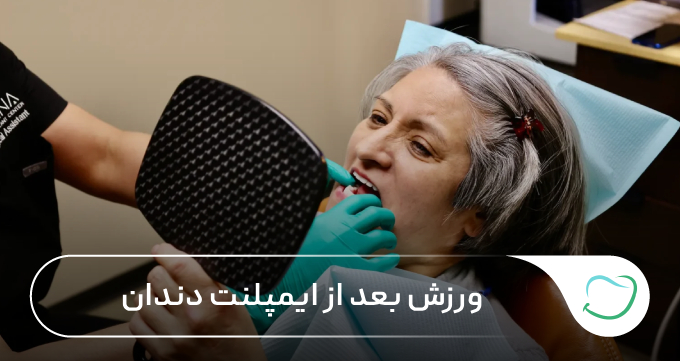 ورزش بعد از ایمپلنت دندان 🦷【سال1405】✅ ورزش بعد از ایمپلنت دندان 🦷【سال1405】✅