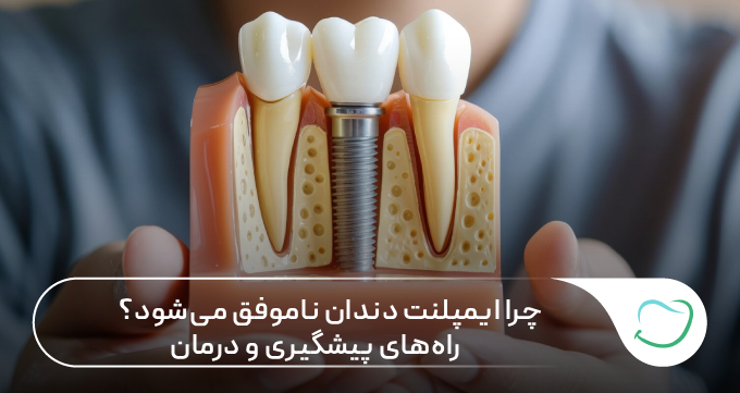چرا ایمپلنت دندان ناموفق میشود؟ راههای پیشگیری و درمان 🦷 چرا ایمپلنت دندان ناموفق میشود؟ راههای پیشگیری و درمان 🦷