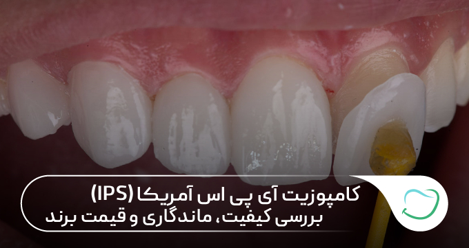 کامپوزیت آی پی اس آمریکا (IPS) بررسی کیفیت، ماندگاری ⭐ کامپوزیت آی پی اس آمریکا (IPS) بررسی کیفیت، ماندگاری ⭐