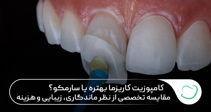 کامپوزیت کاریزما بهتره یا سارمکو؟ مقایسه تخصصی از نظر ماندگاری، زیبایی و هزینه کامپوزیت کاریزما بهتره یا سارمکو؟ مقایسه تخصصی از نظر ماندگاری، زیبایی و هزینه