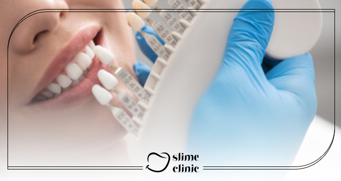 لمینت کریستالی چیست و چه تفاوتی با لمینت معمولی و کامپوزیت دارد؟ 🦷⚡ لمینت کریستالی چیست و چه تفاوتی با لمینت معمولی و کامپوزیت دارد؟ 🦷⚡