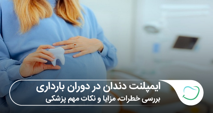 ایمپلنت دندان در دوران بارداری | بررسی کامل خطرات، مزایا و نکات مهم پزشکی🦷 ایمپلنت دندان در دوران بارداری | بررسی کامل خطرات، مزایا و نکات مهم پزشکی🦷