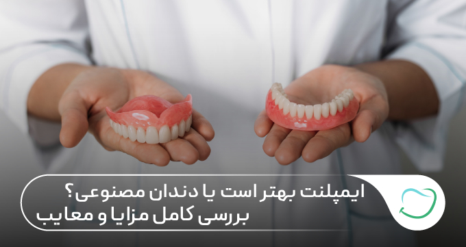 ایمپلنت بهتر است یا دندان مصنوعی؟ بررسی کامل مزایا و معایب 🦷✅ ایمپلنت بهتر است یا دندان مصنوعی؟ بررسی کامل مزایا و معایب 🦷✅