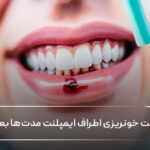 علت خونریزی اطراف ایمپلنت مدتها بعد از جراحی چیست؟ 🦷💗 علت خونریزی اطراف ایمپلنت مدتها بعد از جراحی چیست؟ 🦷💗