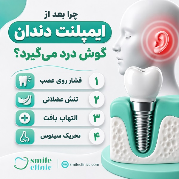 چرا بعد از ایمپلنت دندان گوش درد میگیرد؟