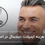 هزینه ایمپلنت دیجیتال در اصفهان🦷【سال1405】❤️ هزینه ایمپلنت دیجیتال در اصفهان🦷【سال1405】❤️