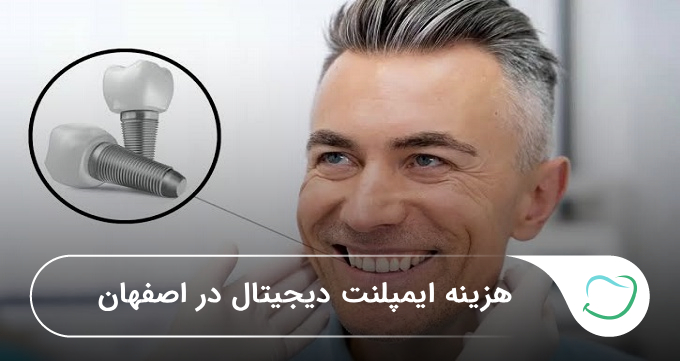 هزینه ایمپلنت دیجیتال در اصفهان🦷【سال1405】❤️ هزینه ایمپلنت دیجیتال در اصفهان🦷【سال1405】❤️