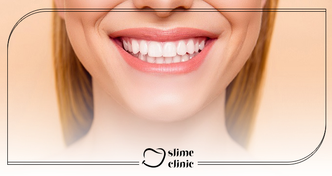 چگونه میتوان از تغییر رنگ کامپوزیت دندان جلوگیری کرد؟
