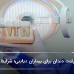 ایمپلنت دندان برای بیماران دیابتی؛ شرایط و نکات مهم 🦷【سال1405】 ایمپلنت دندان برای بیماران دیابتی؛ شرایط و نکات مهم 🦷【سال1405】
