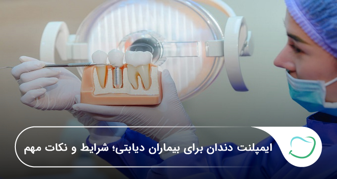 ایمپلنت دندان برای بیماران دیابتی؛ شرایط و نکات مهم 🦷【سال1405】 ایمپلنت دندان برای بیماران دیابتی؛ شرایط و نکات مهم 🦷【سال1405】