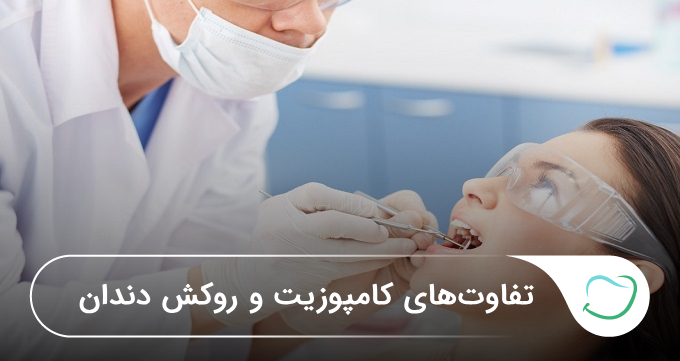 تفاوتهای کامپوزیت و روکش دندان🦷【سال1405】❤️ تفاوتهای کامپوزیت و روکش دندان🦷【سال1405】❤️