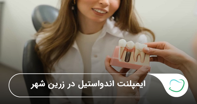 ایمپلنت اندواستیل در زرین شهر 🦷【سال1405】❤️ ایمپلنت اندواستیل در زرین شهر 🦷【سال1405】❤️